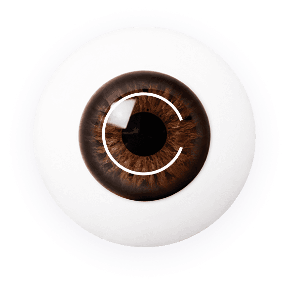 LASIK ทั่วไป